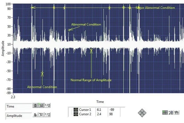 A comparison chart showing the sound frequency of a healthy motor bearing (low-decibel, ultrasonic) versus a faulty one (higher decibel, audible), illustrating the link between bearing condition and noise level.